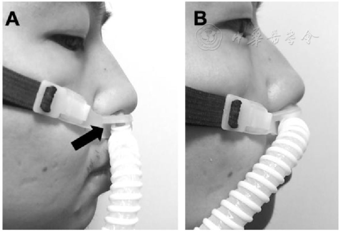 急性呼吸道感染治疗原则,呼吸道感染诊治思路
