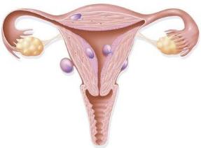 吴令英治疗晚期卵巢癌怎么样,妇科肿瘤吴令英