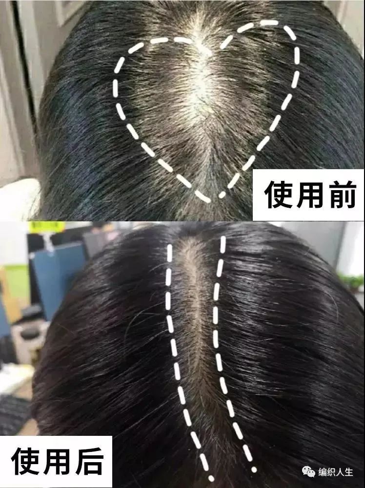 德国老太太用什么洗发水,93岁德国老太太