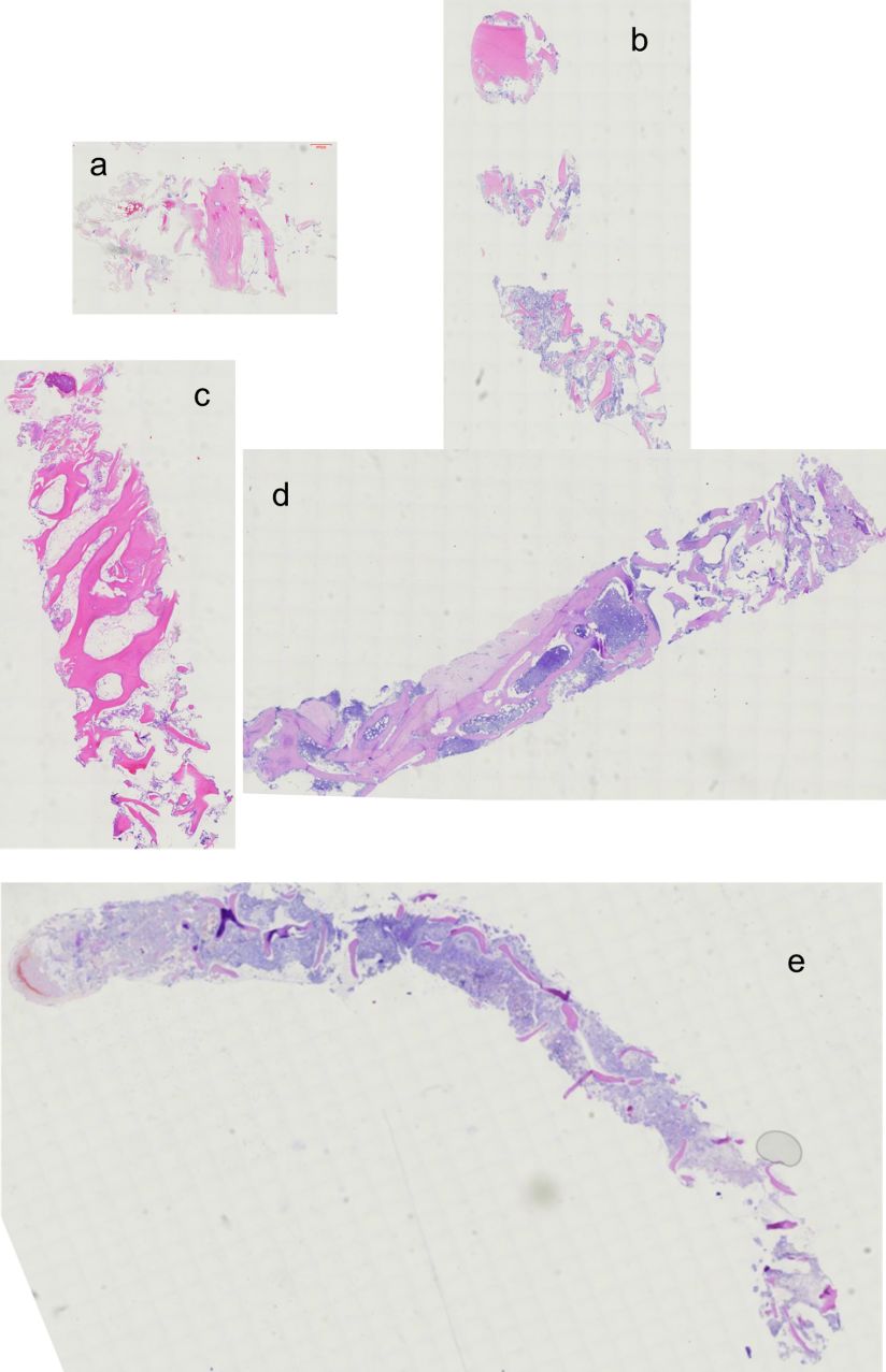 2020年淋巴瘤病理诊断必备知识点,淋巴瘤病理质控