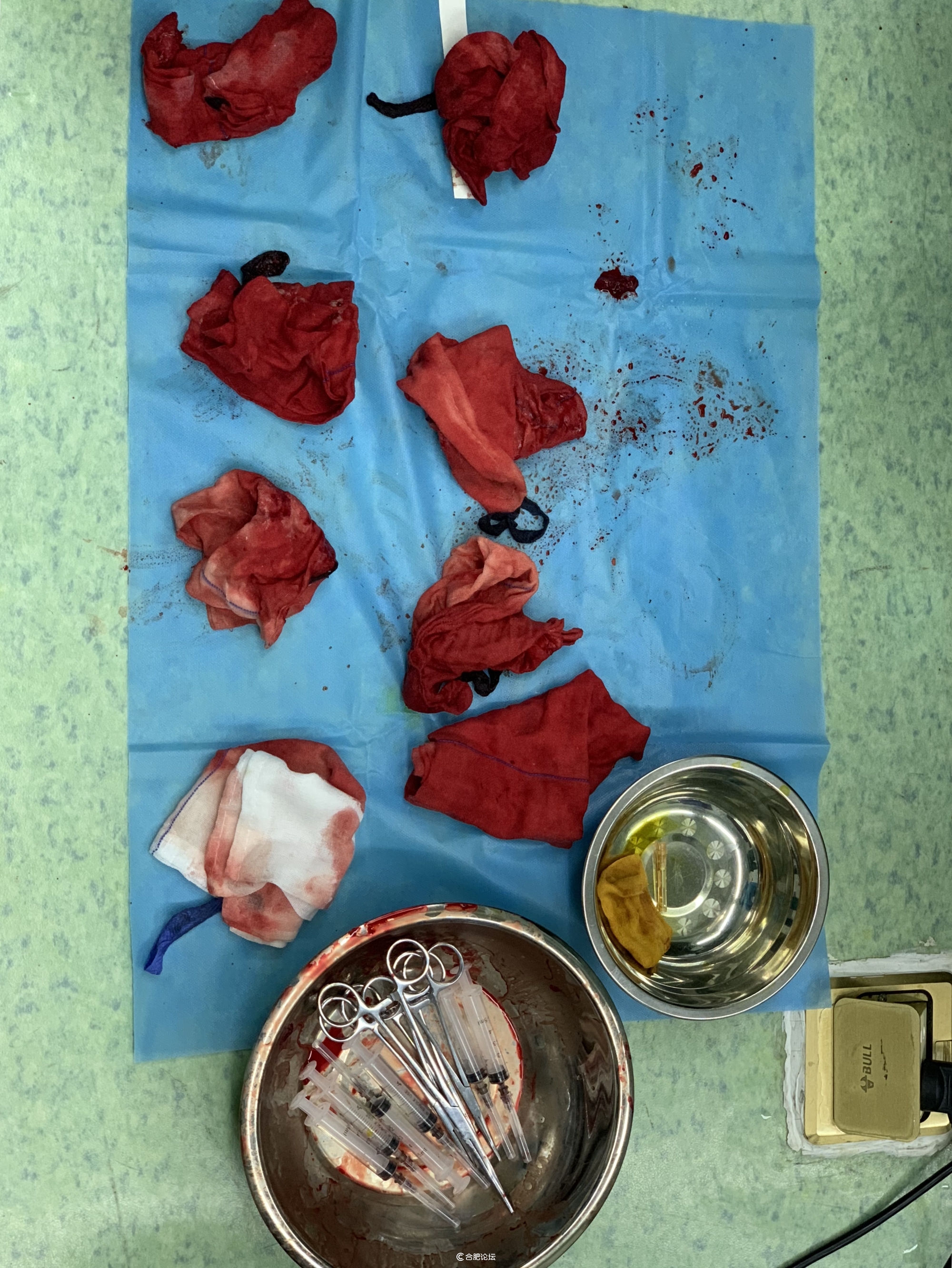 产妇羊水栓塞获救新闻,合肥羊水栓塞产妇