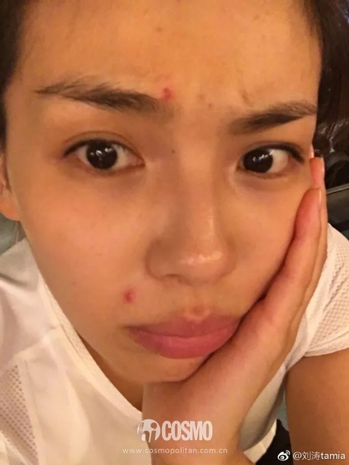 美人计|听说戴口罩之后就疯狂冒痘，我来给你诊断诊断