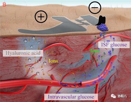 它是如何24h监测你的葡萄糖水平|一页手册·协和八