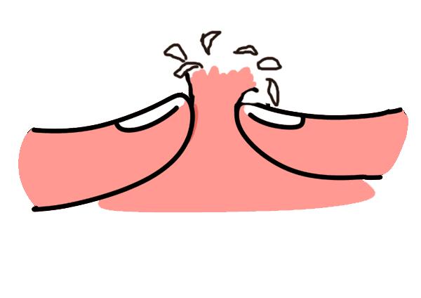 脸上长闭口怎么办教你正确去闭口,长闭口的正确消除方法脸颊