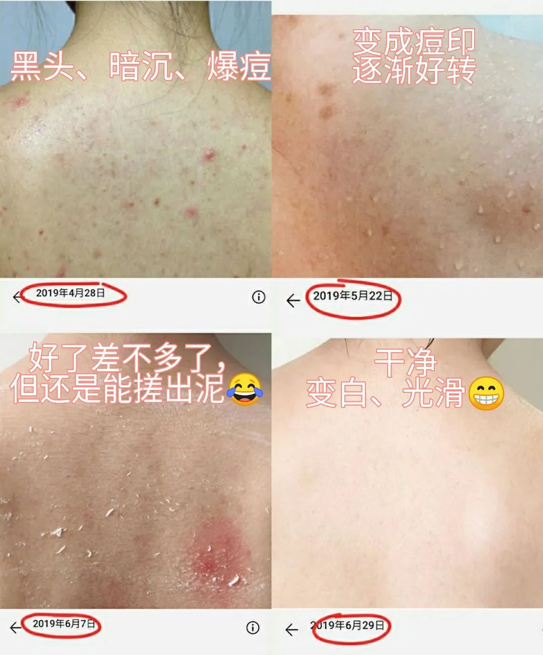 无痛搓泥|日系变态搓澡巾！轻轻搓一搓，泥条劈里啪啦的掉