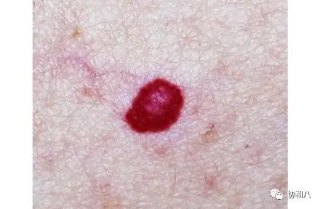 复习这些名解时总觉得怪饿的|协和八·脑洞大开