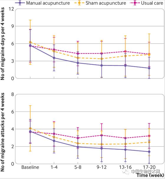 郑州针灸治偏头痛,多中心随机双盲试验