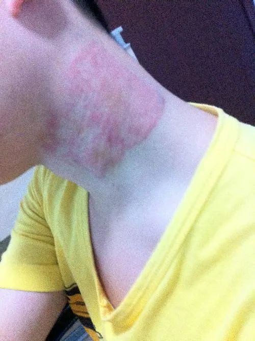 「周三爆款返场」你们要的酸痛大师台湾一条根，来喽