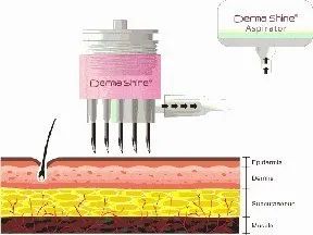 听说戴着口罩，集美们都偷偷在DO脸？
