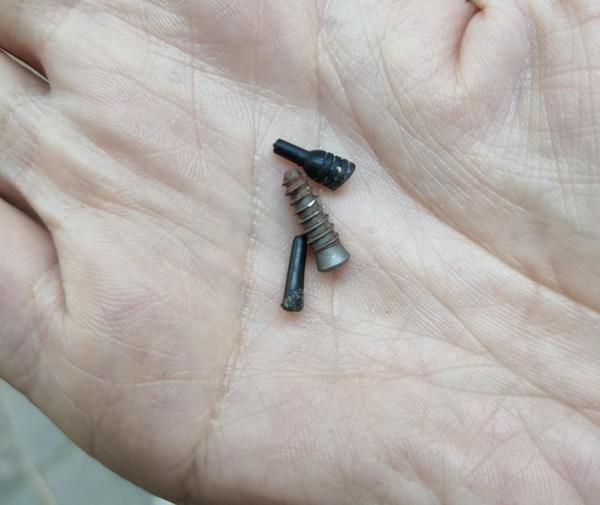 丹东种牙坑人吗,在私人诊所种牙靠谱吗