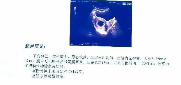 受孕后怎么检测准确率高,受孕后可以做什么检查