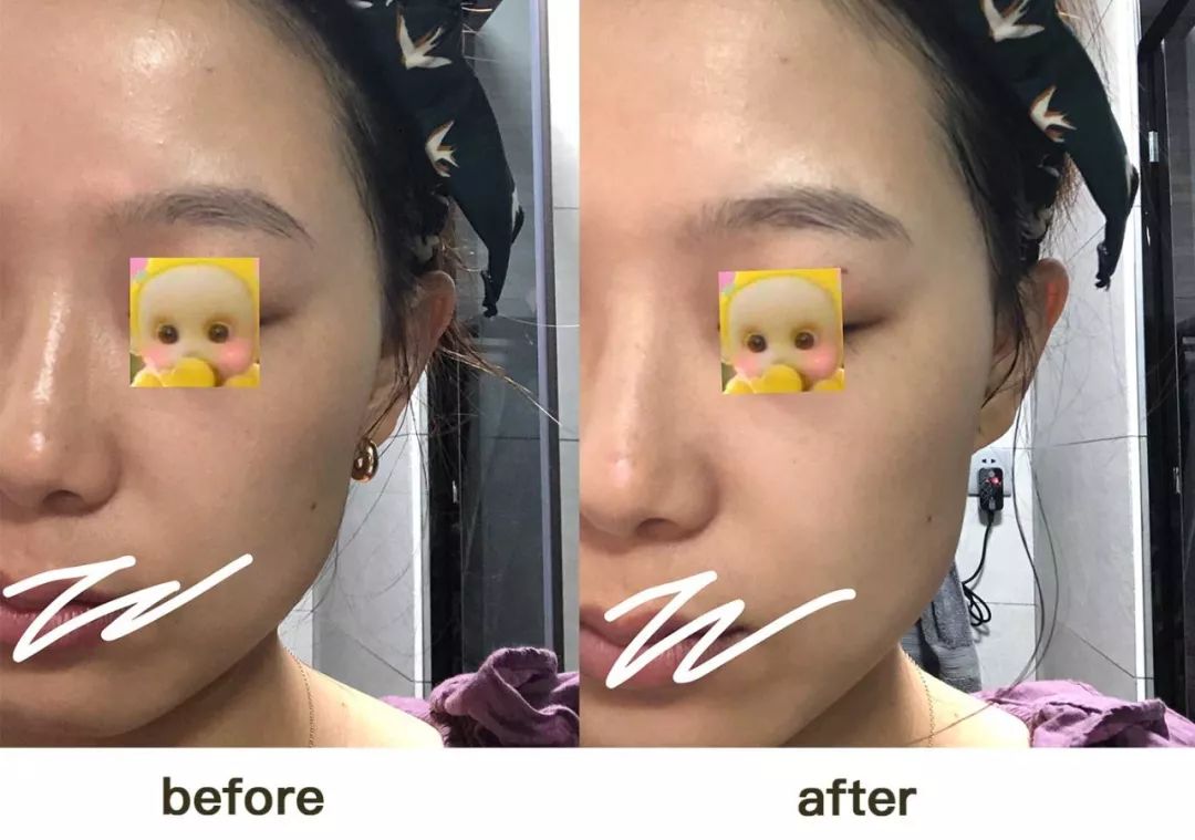 姘村綋褰撶殑鐨偆鎬庝箞鑾峰緱,姘村綋褰撶殑鐨偆