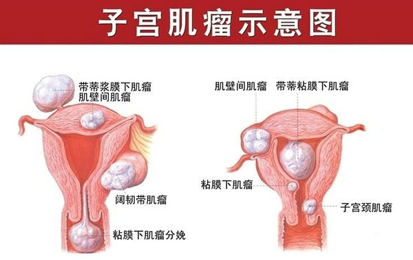 患者腹疼难忍,腹如刀绞是什么感觉