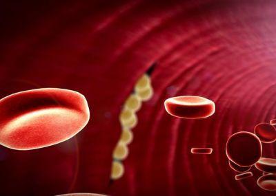 胸部手术局部麻醉打哪里,胸科手术麻醉风险