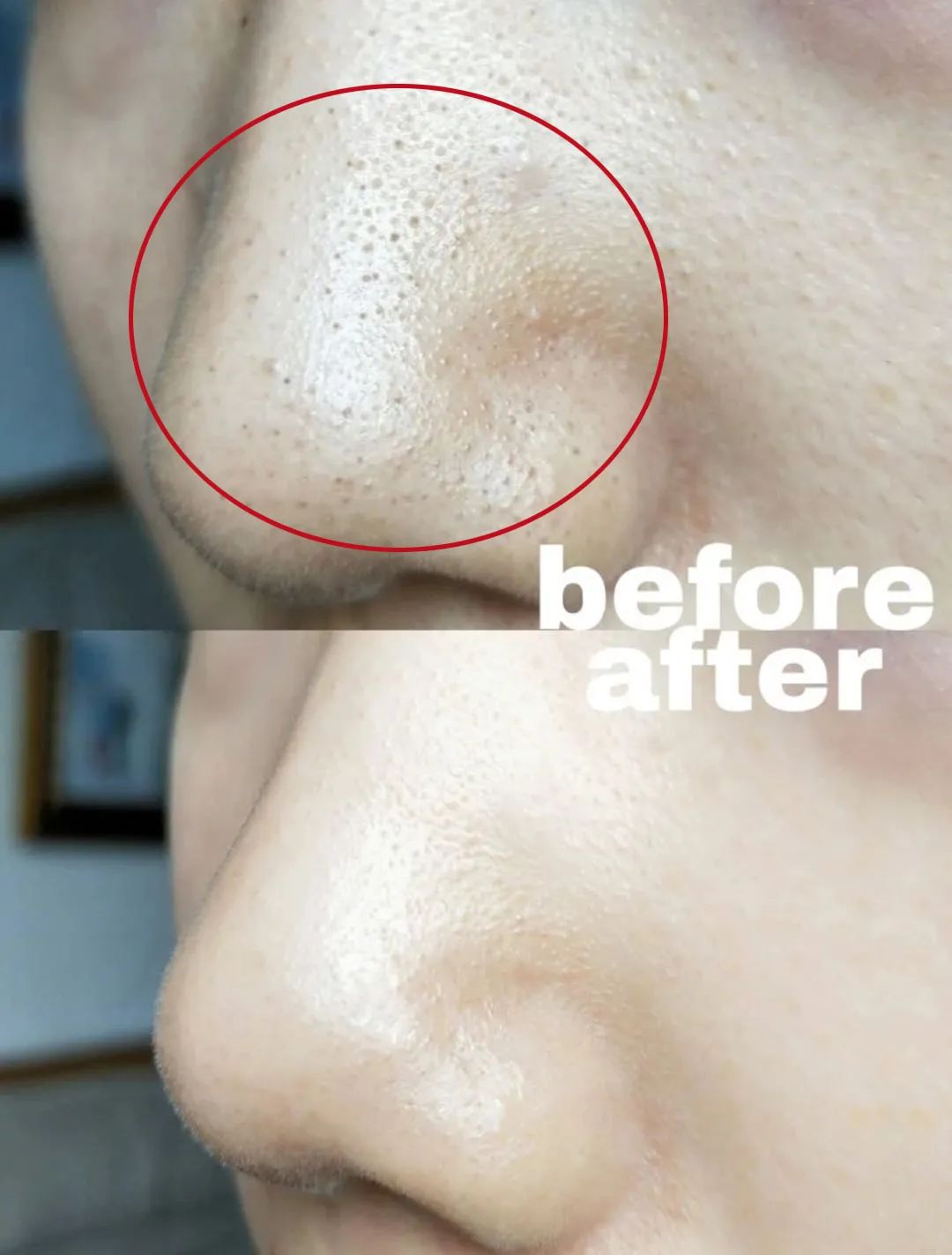 洗出脸上的脏东西解压,清除脸上斑块的产品