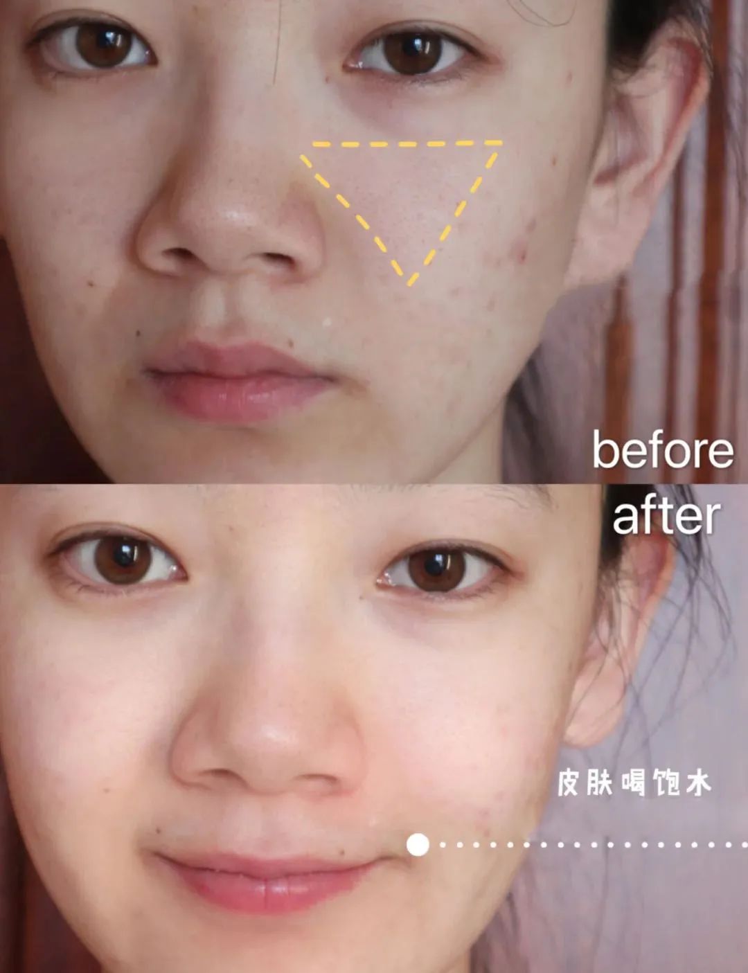 洗出脸上的脏东西解压,清除脸上斑块的产品