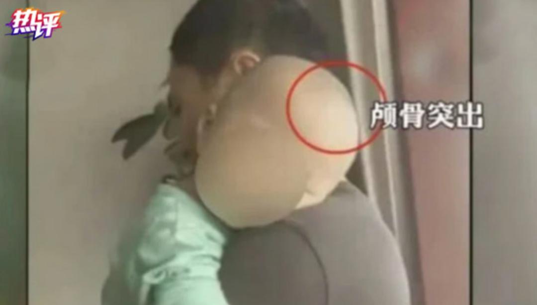 专业配方奶粉标准,医用配方奶粉推荐