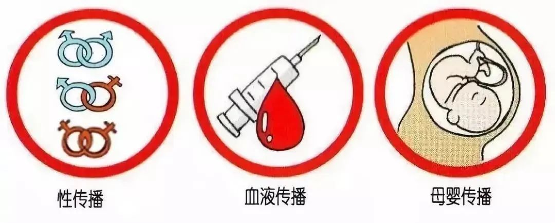 历史|艾滋病：始于恐慌终于关怀