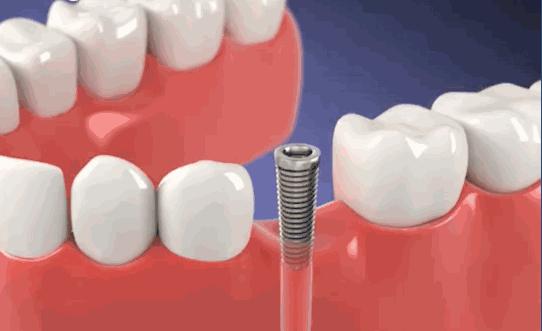 517吃货节来袭！缺它吃不快乐！千元补贴快领