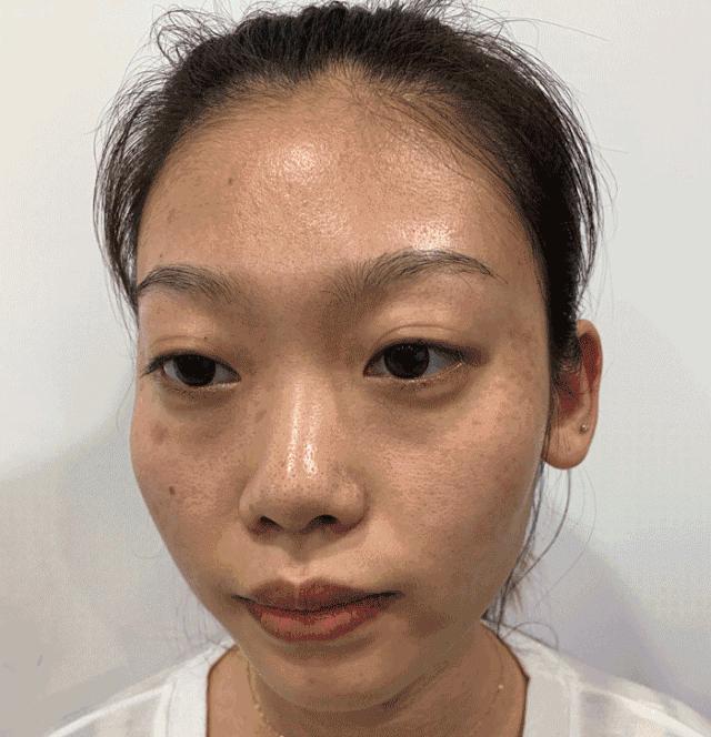 喝胶原蛋白要坚持多久才能有效果,紧急提醒经常喝这个的人要注意了