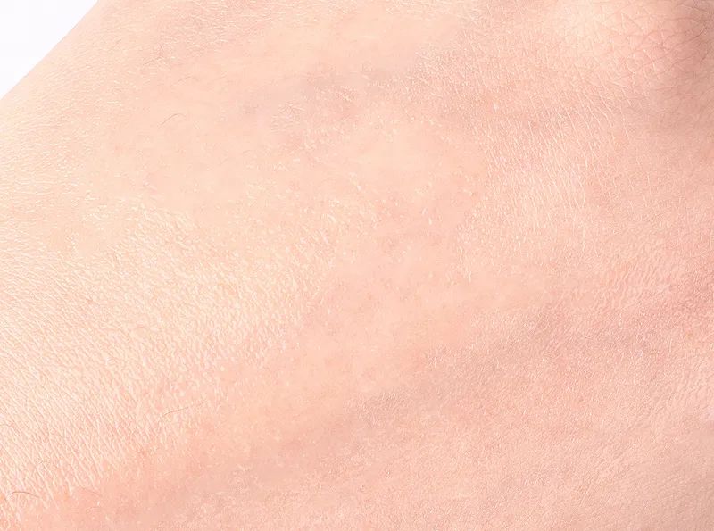 眼霜中的爱马仕!清爽不长脂肪粒,去黑眼圈效果秒2000元腊梅,亲测有效