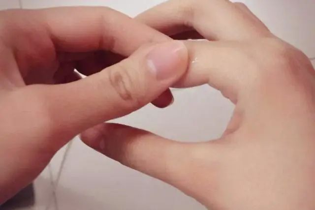 注意｜手上长水泡瘙痒难消？医生提醒：这症状夏天高发