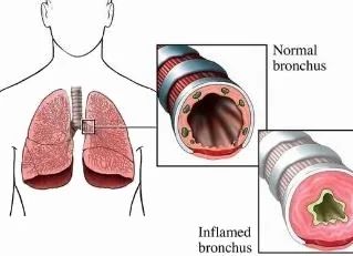 杭州今日入梅，梅雨季节居家除霉妙招请收好
