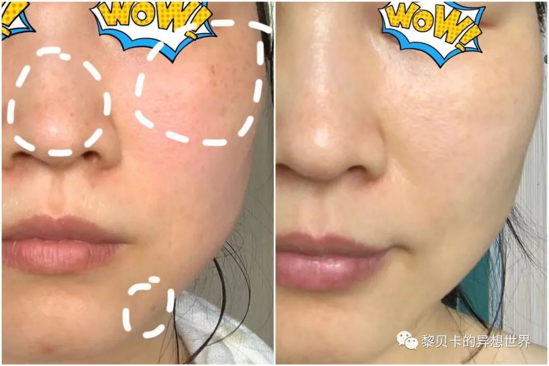 做完医美真的能换脸吗,做完医美需要注意什么