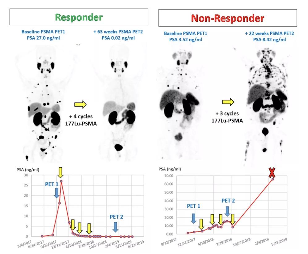 asco治疗的最新进展,2020asco肾癌治疗进展