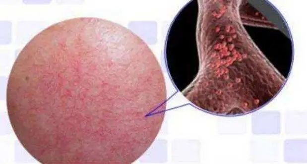 百人测评团|蒸笼天里,想让肌肤“一秒入水”,可能吗?