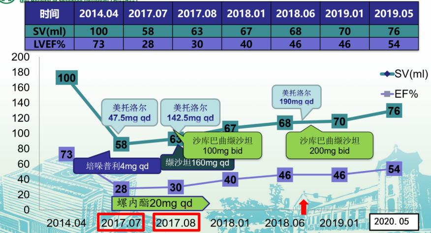 心衰患者睡眠质量差,心衰病人的日常生活现状