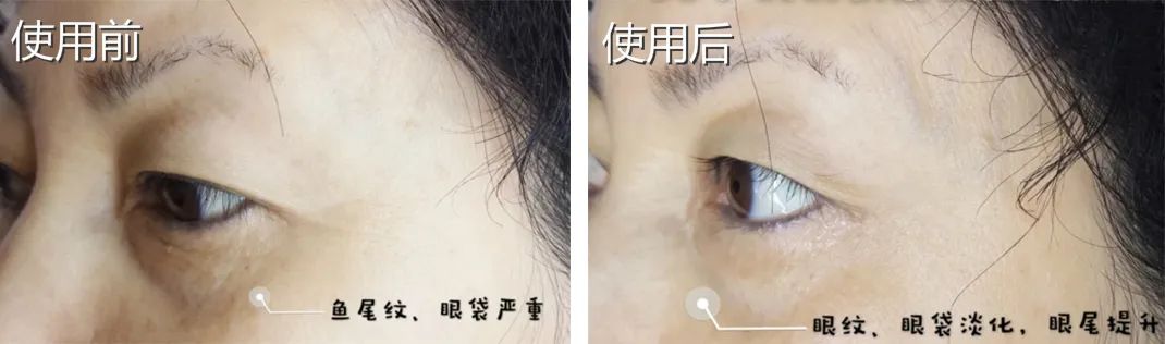 国货眼霜马应龙八宝,马应龙去黑眼霜官方旗舰店