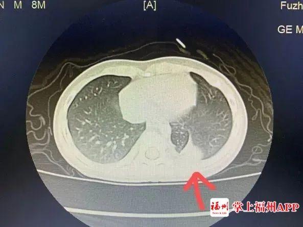 5个月宝宝咳嗽反复发烧38.5,8岁孩子反复发烧咳嗽厉害持续5天