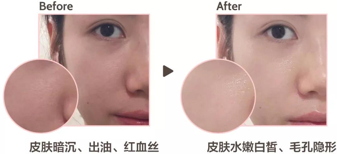 11块钱淡斑体验,1元享受美容养生护理无隐形消费