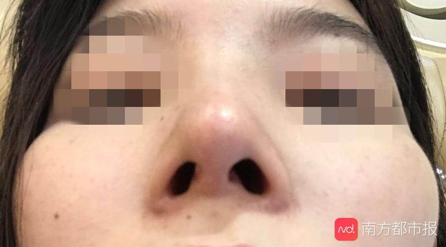 医美乱象曝光整治,医美整容乱象调查