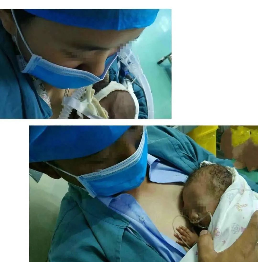 装在口袋里的爱,什么是袋鼠式护理