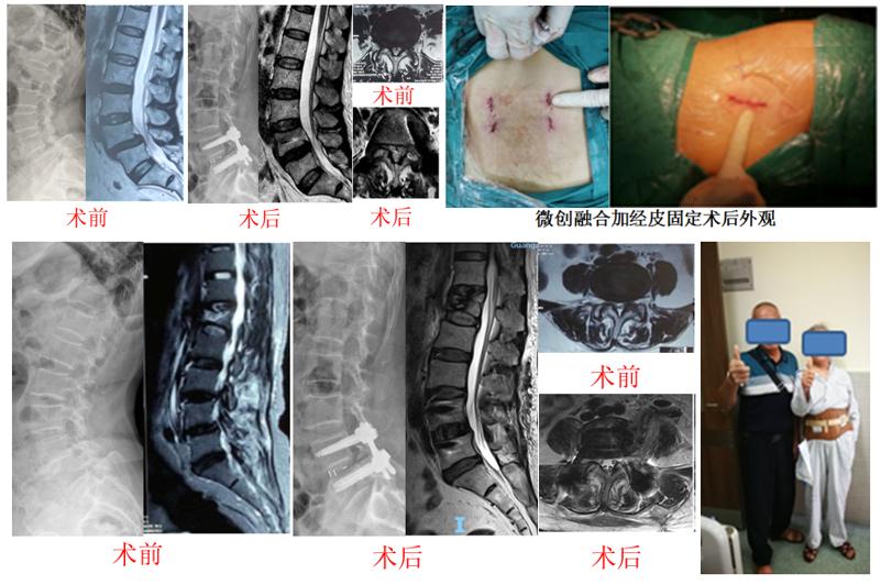 筋骨堂治疗视频,筋骨堂治疗效果怎么样