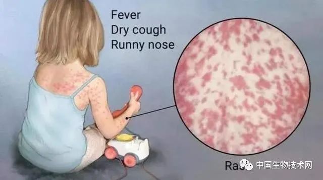 《自然通讯》:不止新冠大流行,死灰复燃的“猩红热”已重出江湖