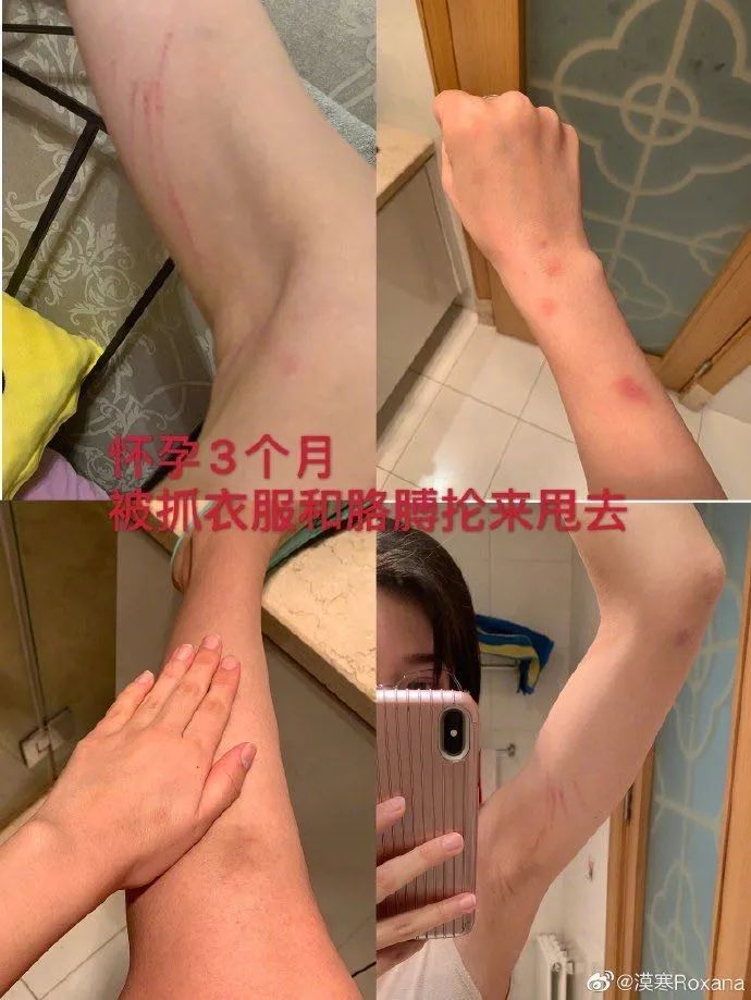 男运动员被家暴,运动员被家暴