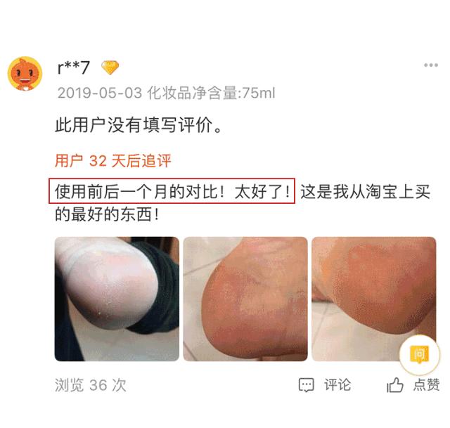 你穿高跟鞋经历过磨脚的痛苦吗,穿高跟鞋脚掌死皮怎么去除
