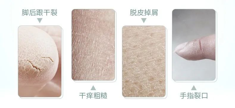 李佳琦赞不绝口的全能乳膏，一年卖出600万瓶，秋冬有它，皮肤再也不干燥