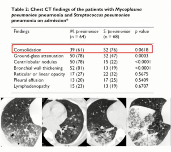 支原体肺炎症状应该注意什么,支原体肺炎这些症状要警惕