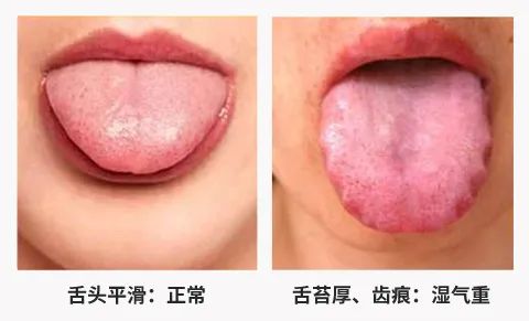 湿气重排不出去吃什么效果好,湿气重不容易瘦怎么办