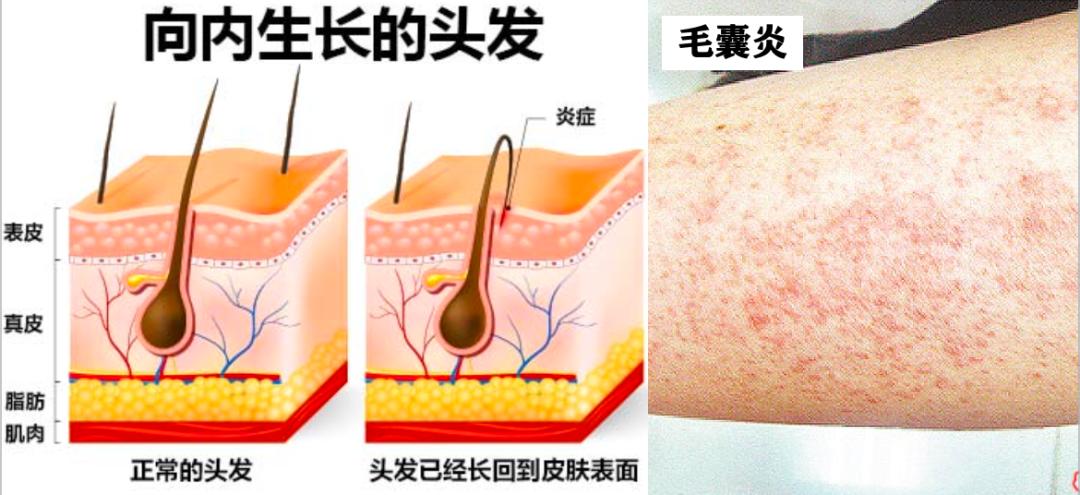 腿粗暗沉粗糙？为什么教程也救不了你的颜值bug？