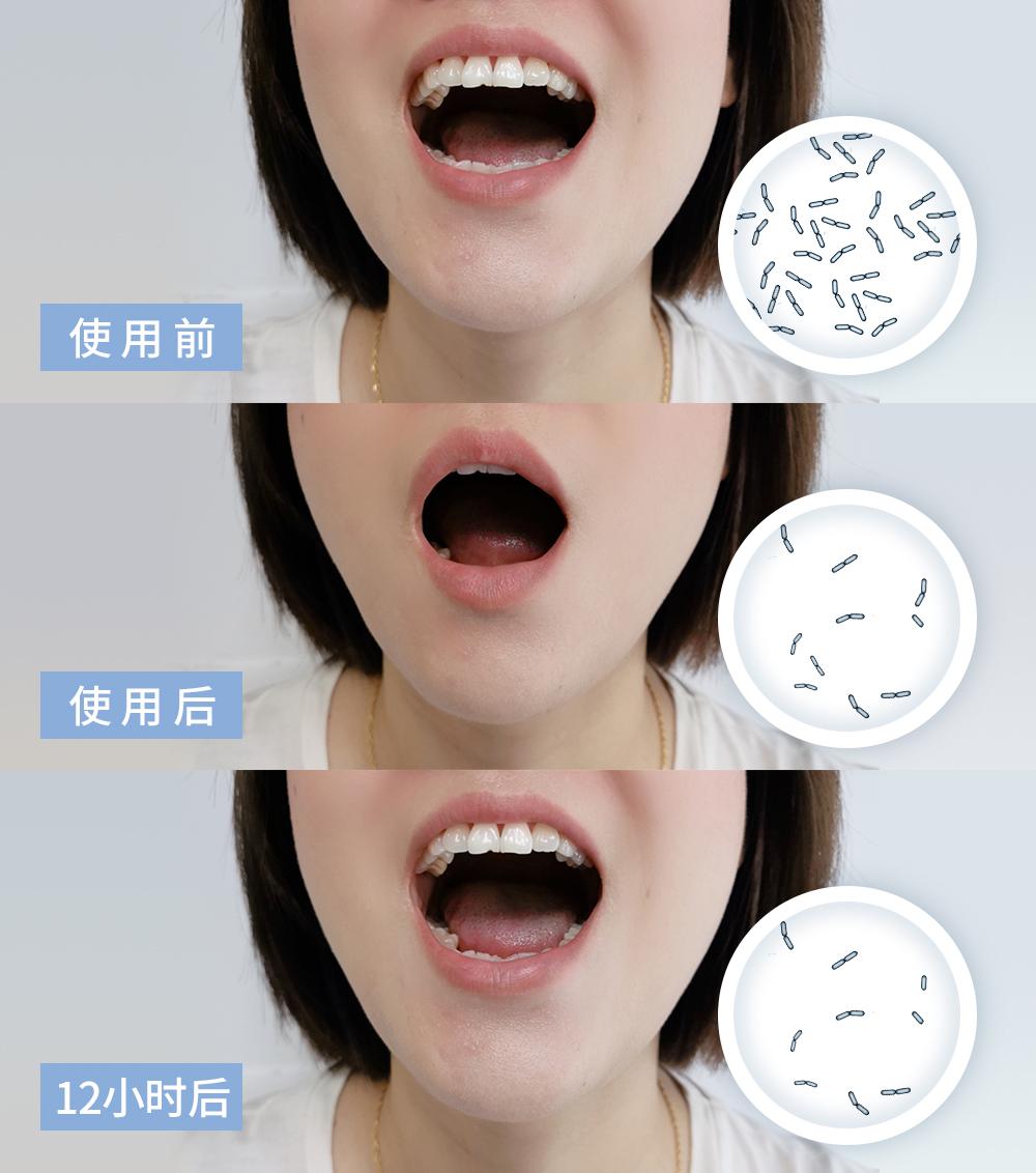 口臭的解决方法胃不好,口臭是不是胃不好了应该怎么调理