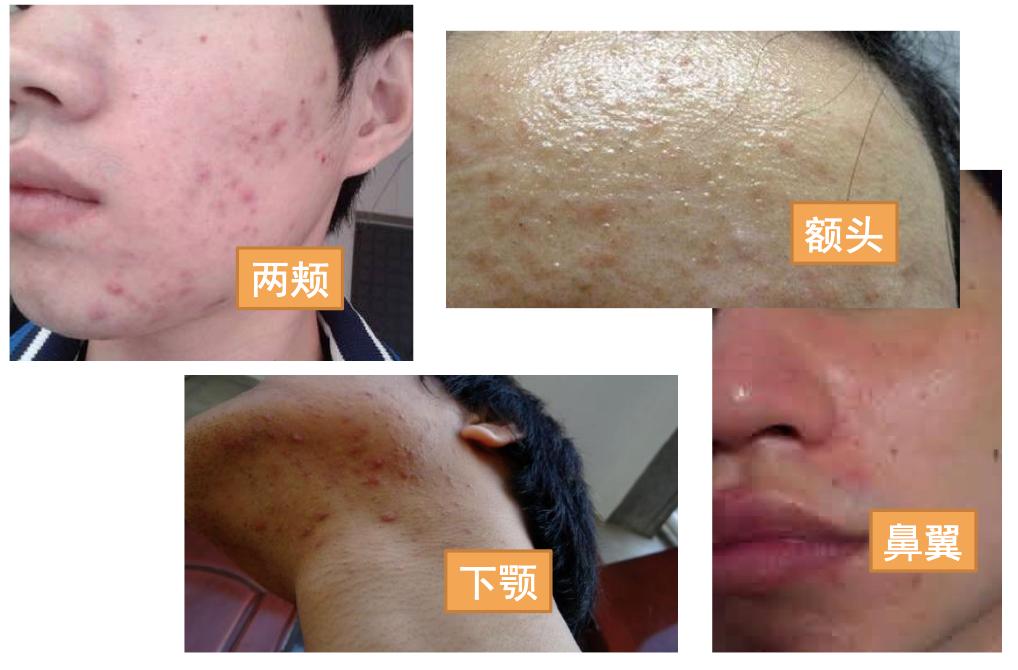 还在用洗面奶让你的脸越洗越白,还在用的洗面奶