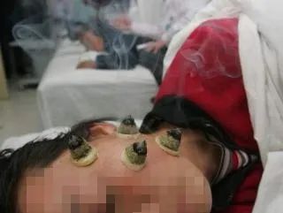 专病门诊有专家吗,江苏省人民医院面瘫专病门诊