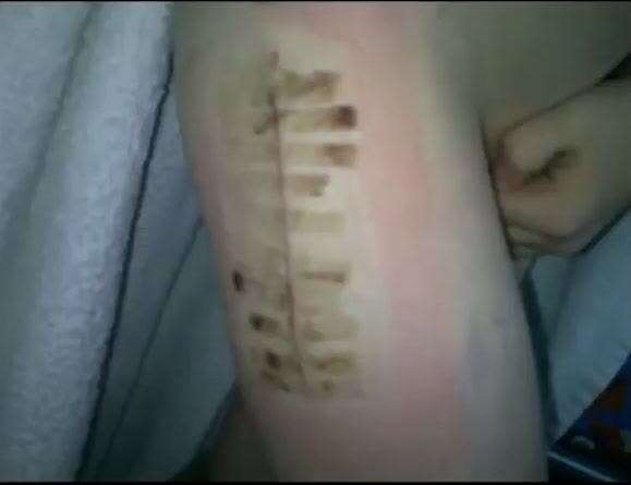 罹患重病也能成职业球员?足球这样给他第二次生命