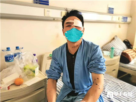 惊险!昆明一男子用强碱疏通下水道碱水入眼烧伤角膜