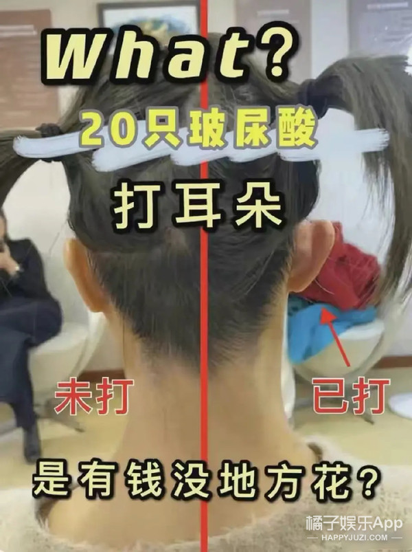 整容整腰,整容整的满脸高科技却一点不高级